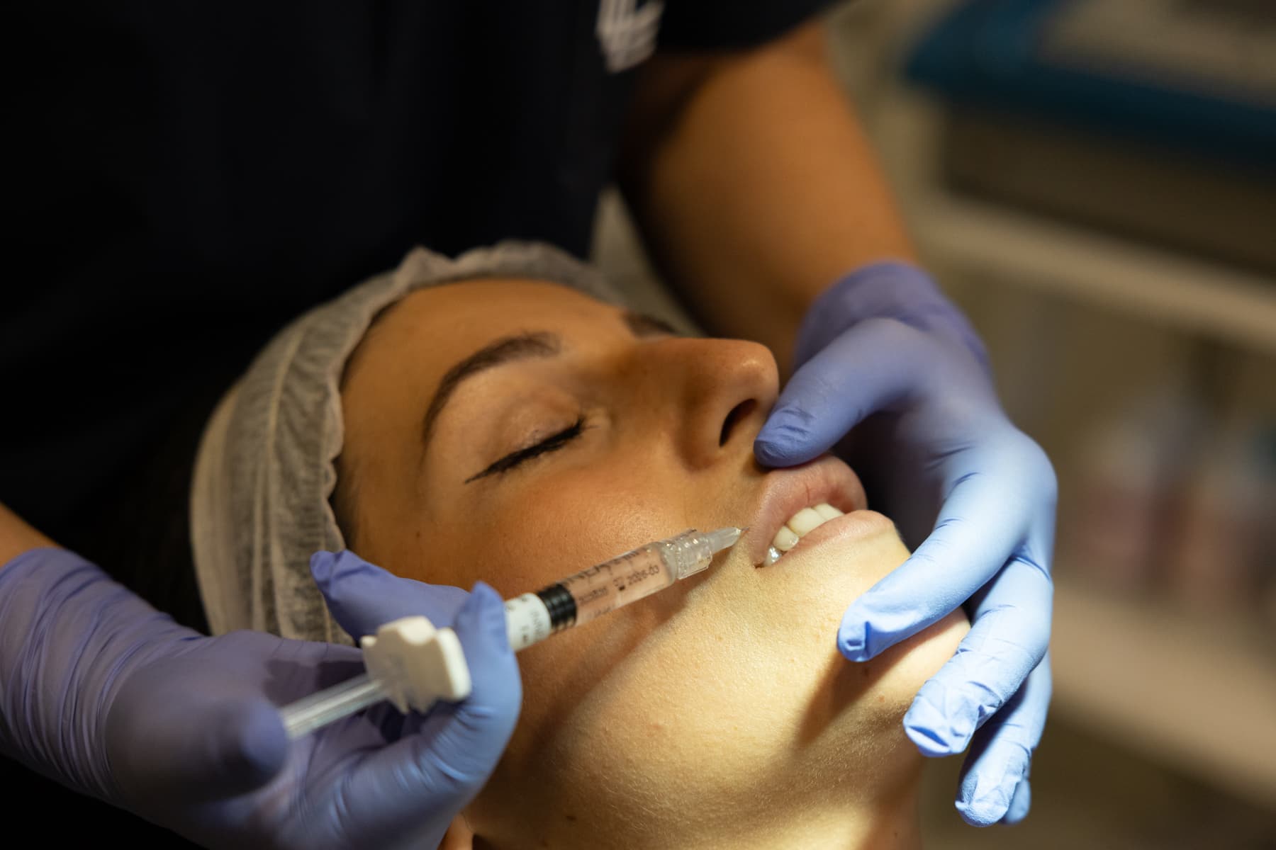 Trattamenti estetici minimamente invasivi - Studio Dentistico Lolli